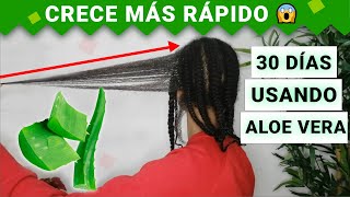 INDIGENA RECOMIENDA TRATAMIENTO ANCESTRAL para CAIDA del CABELLO  ORTIGA🍀  LuxoryEM👌 [upl. by Ijok]