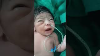 Feeding tube newborn baby ojha trending baby [upl. by Lisetta174]