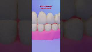 DANB test prep Chair side dental charting what is it dentalassistanteducation dentalassisting [upl. by Dnalyk]