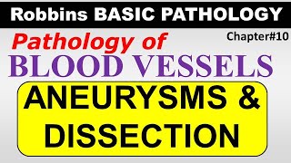 Ch12  Aneurysms amp Dissection  Blood Vessel Pathology  Robbins Lectures [upl. by Eerolam]