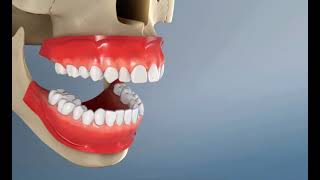 Redresser et aligner ses dents  Les gouttières Orthodontiques ￼invisibles [upl. by Gautious]