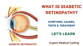 What is Diabetic RetinopathySymptomsCausesComplicationsTestsTreatmentPrecautionMedical Coding [upl. by Goat]