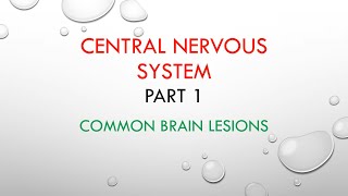 Common Brain Lesions CNS pathology [upl. by Anidene]