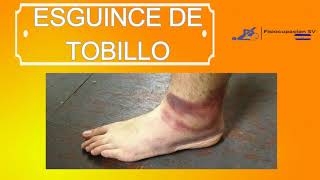 ESGUINCE DE TOBILLO  Fisioterapia y Terapia Ocupacional  Fisiocupacion SV [upl. by Bald780]