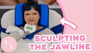 Jada Desiree  Chin CoolSculpting Experience [upl. by Ahsiened]