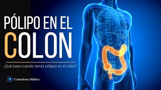 Pólipo en el Colon Definición Tipos Riesgos Síntomas Pruebas y Tratamiento 👩🏻‍⚕️ Consultorio [upl. by Adelric]