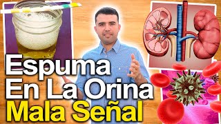 Espuma En La Orina  Qué Significa  Causas Y Enfermedades Que Producen Espuma Orina [upl. by Adaynek498]