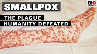 Smallpox The Plague That Humanity Defeated [upl. by Nuli831]