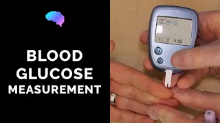 Blood Glucose Measurement  CBG  OSCE Guide  UKMLA  CPSA [upl. by Adnahsed416]