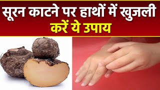 सूरन काटने पर हाथों में खुजली दूर करने के जबरदस्त उपाय  Boldsky Health [upl. by Liagibba]