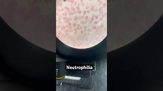 Neutrophilia live microscopy  youtubeshorts youtube [upl. by Harias608]