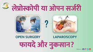 Open Vs Laparoscopic Surgery Which is the Best Procedure  Dr Monika Sachdeva [upl. by Lanod]