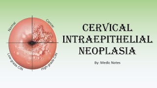 Epithelial Dysplasia Definition  Features of Dysplasia l Grading of Dysplasia  Carcinoma in situ [upl. by Nyrual]