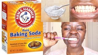 HOW TO WHITENING YOUR TEETH USING BAKING SODA DOES IT WORK [upl. by Gniy689]