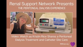 The Peritoneal Dialysis Experience Featuring Kristin Rice [upl. by Harriot]