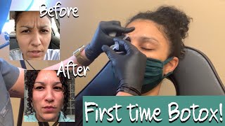 Getting Botox for the First Time for Glabella lines Eleven 11 lines [upl. by Estel956]