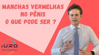 Manchas Vermelhas no Pênis  O que pode ser [upl. by Netsirhc]