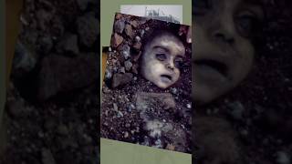 Worst Industrial Accident Bhopal Gas Tragedy [upl. by Whittemore]