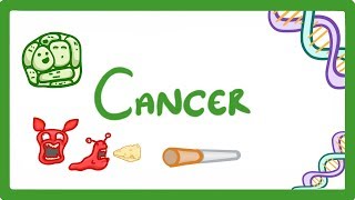 GCSE Biology  What is Cancer Benign and Malignant Tumours Explained 43 [upl. by Presber]