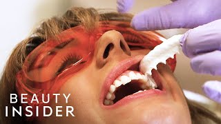 The Fastest Way Dentists Whiten Teeth  Beauty Explorers  Beauty Insider [upl. by Tehcac97]