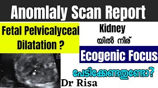 Abnormalities in Fetal Scan Report Malayalam  Fetal Pelvicalyceal Dilatation EIF [upl. by Atiuqram875]