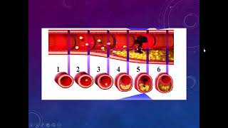 Cardiopatía isquémica II  AngioCardiología  sem 6 [upl. by Zacharie]