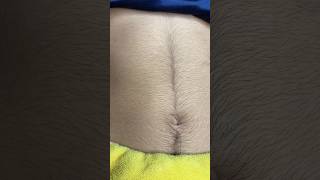 How to remove tummy unwanted hair skincare waxingathome waxing waxingexpert beauty waxingkit [upl. by Nwahsak]