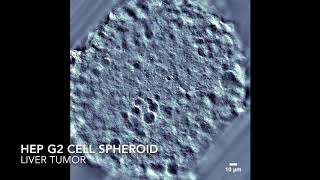 HepG2 Cell Spheroid [upl. by Nipsirc]