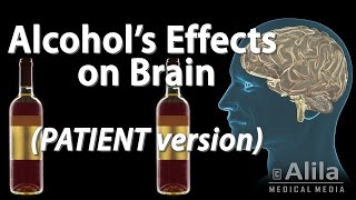 Alcohol Effects on the Brain PATIENT Version Animation [upl. by Eizzo]