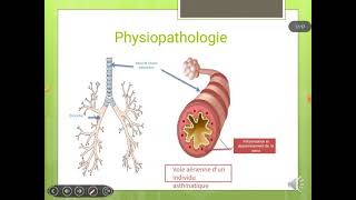 cours 05 pneumologie  asthme bronchique [upl. by Atnahs]