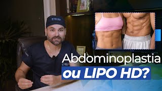 LIPO HD OU ABDOMINOPLASTIA [upl. by Firman]