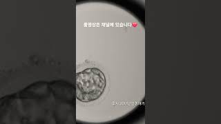 모자이시즘 배아 분열과정 Embryoscope timelapse 시험관 난임 5일배양 모자이시즘 pgt염색체 배아분열과정 [upl. by Lezirg]