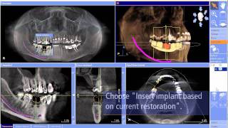 CEREC meet Galileos details en werkwijze bij Henry Schein Nederland [upl. by Ierdna]