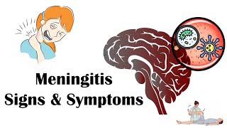 Meningitis  Signs amp Symptoms Most Common Signs amp Symptoms Of Meningitis [upl. by Niddala229]