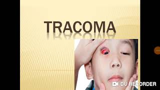 Tracoma  características sintomas transmissão etc [upl. by Soisanahta]