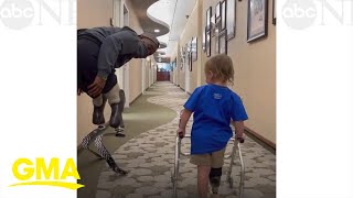 I’m not crying you are Watch as this amputee toddler walks for the first time [upl. by Atihcnoc]