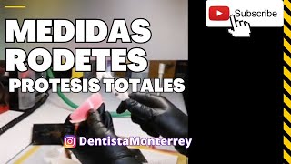 🤔CUÁNTO MIDEN ❓Los RODETES de CERA 👅 Prótesis TOTALES [upl. by Eisac784]