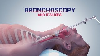 BRONCHOSCOPY  ITS USES I DR NAVEEN KUMAR AILAWADI I CHEST SPECIALIST [upl. by Hanschen]