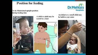 Button Gastrostomy Feeding [upl. by Nelleoj]