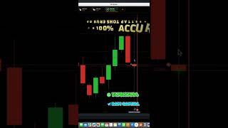 🔍 Binary Options vs Forex Which is Better [upl. by Ninnetta644]