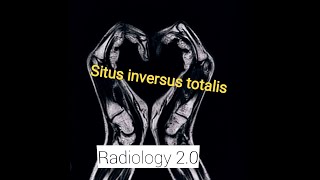 Case Report CT AbdomenSitus Inversus Totalis Situs SolitusSitus AmbiguusHeterotaxia syndrom [upl. by Nyllaf]