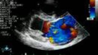 Mitral Regurgitation  Color Doppler Echocardiogram  Dog [upl. by Enhpad]