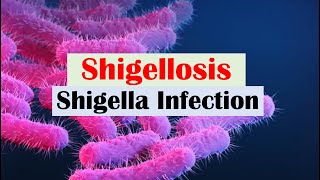 Shigellosis Shigella “A Cause of Bloody Diarrhea” Pathophysiology Symptoms Diagnosis Treatment [upl. by Cida]