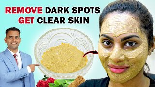 Remove Dark Spots and Get Clear Skin Naturally At Home  Dr Vivek Joshi [upl. by Itoc]