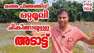 മഞ്ഞ പിത്തത്തിന് ഒറ്റമൂലി ചികിത്സയുടെ നാട് Village vlog Entertainment video AJUS WORLD [upl. by Llenoil]