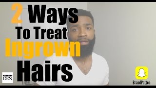 2 Ways To Treat Ingrown Hairs In 2 Minutes [upl. by Gilson]