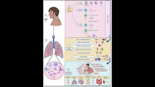 pneumonia vs tuberculosis  Medical Common Sense [upl. by Antonia]