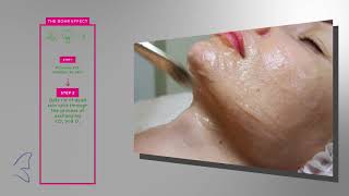 NonInvasive Skin Rejuvenation with Crystal Carboxy CO2 Mask [upl. by Tri499]