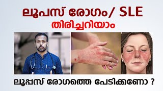 മുഖത്തും ശരീര ഭാഗങ്ങളിൽ ഈ ലക്ഷണങ്ങൾ ഉണ്ടോ  സൂക്ഷിക്കുക  SLE or Lupus Disease Malayalam [upl. by Adnyl]