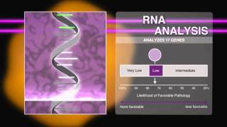 Oncotype DX® Prostate Cancer [upl. by Ennairam]